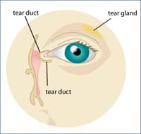 Dry Eye Syndrome Cleveland